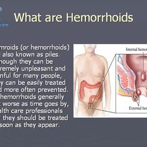 Child Hemroid - Natural Treatment For Hemorrhoids - Hemorrhoid Cushion - Dog Hemorrhoids